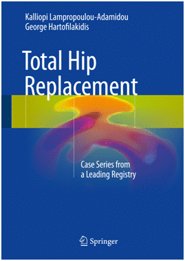 TOTAL HIP REPLACEMENT. CASE SERIES FROM A LEADING REGISTRY