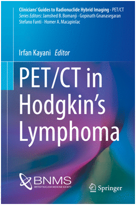 PET/CT IN HODGKIN�S LYMPHOMA