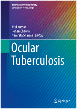 OCULAR TUBERCULOSIS