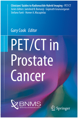 PET/CT IN PROSTATE CANCER