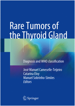 RARE TUMORS OF THE THYROID GLAND. DIAGNOSIS AND WHO CLASSIFICATION