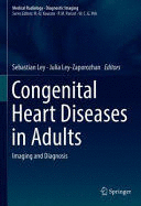 CONGENITAL HEART DISEASES IN ADULTS. IMAGING AND DIAGNOSIS