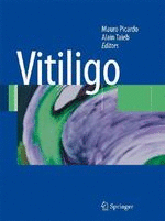 VITILIGO. 2ND EDITION