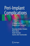 PERI-IMPLANT COMPLICATIONS. A CLINICAL GUIDE TO DIAGNOSIS AND TREATMENT