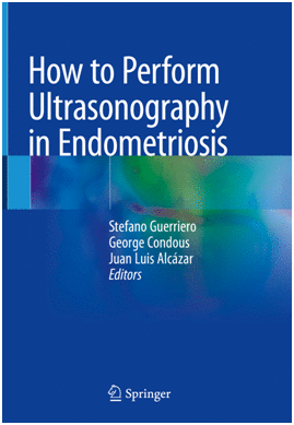 HOW TO PERFORM ULTRASONOGRAPHY IN ENDOMETRIOSIS
