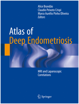 ATLAS OF DEEP ENDOMETRIOSIS. MRI AND LAPAROSCOPIC CORRELATIONS