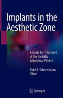 IMPLANTS IN THE AESTHETIC ZONE. A GUIDE FOR TREATMENT OF THE PARTIALLY EDENTULOUS PATIENT