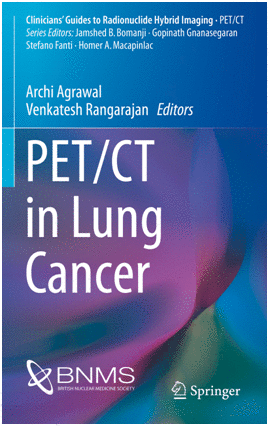 PET/CT IN LUNG CANCER