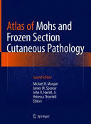 ATLAS OF MOHS AND FROZEN SECTION CUTANEOUS PATHOLOGY. 2ND EDITION