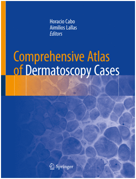 COMPREHENSIVE ATLAS OF DERMATOSCOPY CASES
