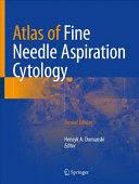 ATLAS OF FINE NEEDLE ASPIRATION CYTOLOGY. 2ND EDITION
