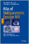 ATLAS OF MULTIPARAMETRIC PROSTATE MRI. WITH PI-RADS APPROACH AND ANATOMIC-MRI-PATHOLOGICAL CORRELATION. (SOFTCOVER)