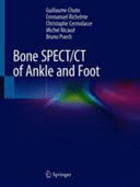 BONE SPECT/CT OF ANKLE AND FOOT