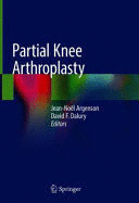 PARTIAL KNEE ARTHROPLASTY