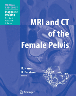 MRI AND CT OF THE FEMALE PELVIS