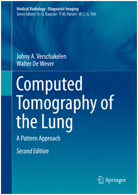 COMPUTED TOMOGRAPHY OF THE LUNG. A PATTERN APPROACH. 2ND EDITION