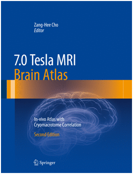 7.0 TESLA MRI BRAIN ATLAS