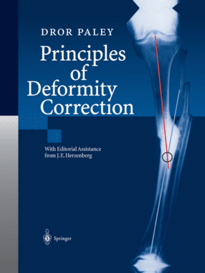 PRINCIPLES OF DEFORMITY CORRECTION
