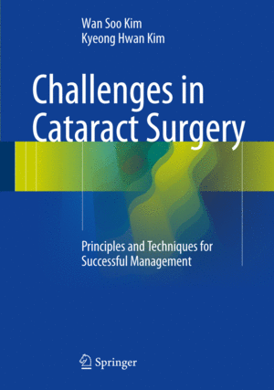 CHALLENGES IN CATARACT SURGERY. PRINCIPLES AND TECHNIQUES FOR SUCCESSFUL MANAGEMENT