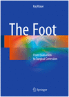 THE FOOT. FROM EVALUATION TO SURGICAL CORRECTION