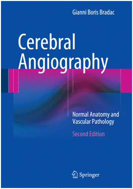 CEREBRAL ANGIOGRAPHY. 2ND EDITION