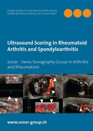 ULTRASOUND SCORING IN RHEUMATOID ARTHRITIS AND SPONDYLOARTHRITIS