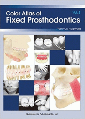 COLOR ATLAS OF FIXED PROSTHODONTICS, VOL. 2