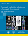 TOMOGRAFIA POR EMISION DE POSITRONES Y TOMOGRAFIA COMPUTARIZADA