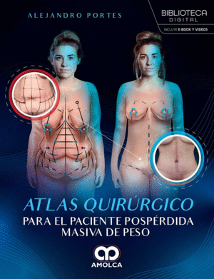 ATLAS QUIRRGICO PARA EL PACIENTE POSPRDIDA MASIVA DE PESO