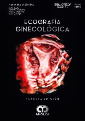 ECOGRAFA GINECOLGICA