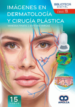 IMGENES EN DERMATOLOGA Y CIRUGA PLSTICA
