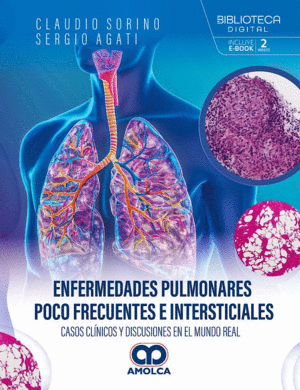 ENFERMEDADES PULMONARES POCO FRECUENTES E INTERSTICIALES
