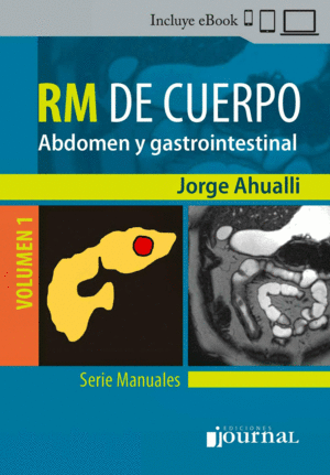 MANUAL DE RM DE CUERPO, VOL. 1: ABDOMEN Y GASTROINTESTINAL