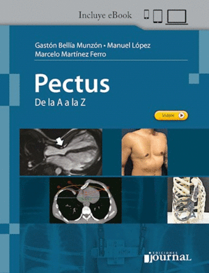 PECTUS. DE LA A A LA Z