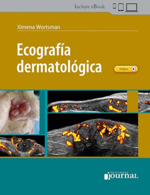 ECOGRAFA DERMATOLGICA