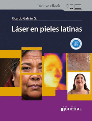 L�SER EN PIELES LATINAS