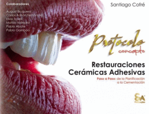 PROTOCOLO CONCEPTO. RESTAURACIONES CER�MICAS ADHESIVAS PASO A PASO. DE LA PLANIFICACI�N A LA CEMENTACI�N