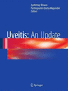 UVEITIS: AN UPDATE