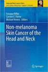 NON-MELANOMA SKIN CANCER OF THE HEAD AND NECK