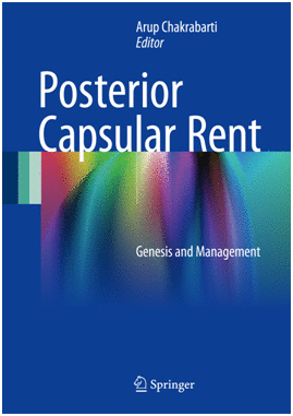 POSTERIOR CAPSULAR RENT. GENESIS AND MANAGEMENT