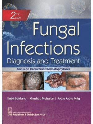FUNGAL INFECTIONS. DIAGNOSIS AND TREATMENT. 2ND EDITION