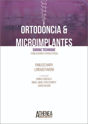 ORTODONCIA & MICROIMPLANTES.  SARDAC TECHNIQUE TCNICA COMPLETA PASO A PASO