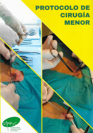 PROTOCOLO DE CIRUGIA MENOR