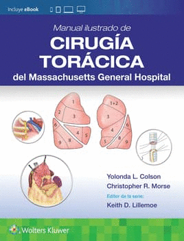 MANUAL ILUSTRADO DE CIRUGA TORCICA DEL MASSACHUSETTS GENERAL HOSPITAL