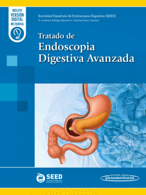 TRATADO DE ENDOSCOPIA DIGESTIVA AVANZADA