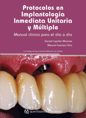 PROTOCOLOS EN IMPLANTOLOGA INMEDIATA UNITARIA Y MLTIPLE. MANUAL CLNICO PARA EL DA A DA