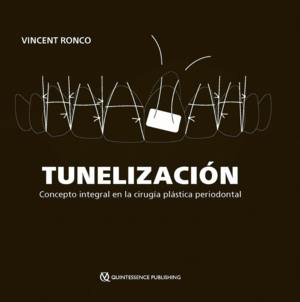 TUNELIZACIN. CONCEPTO INTEGRAL EN LA CIRUGA PLSTICA PERIODONTAL