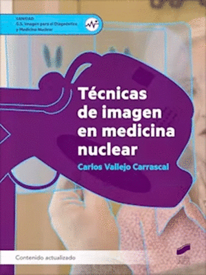 TECNICAS DE IMAGEN EN MEDICINA NUCLEAR