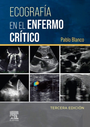ECOGRAFIA EN EL ENFERMO CRITICO