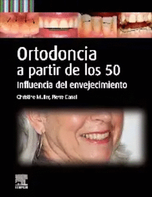 ORTODONCIA A PARTIR DE LOS 50. INFLUENCIA DEL ENVEJECIMIENTO
